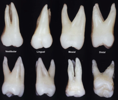 Anatomia Primeiro Molar Superior Odontologistas Odontologistas