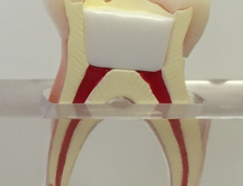 Terapia pulpar na Dentição Decídua